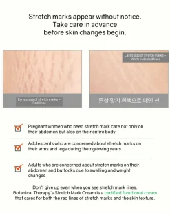 Botanical Therapy Stretch Cream