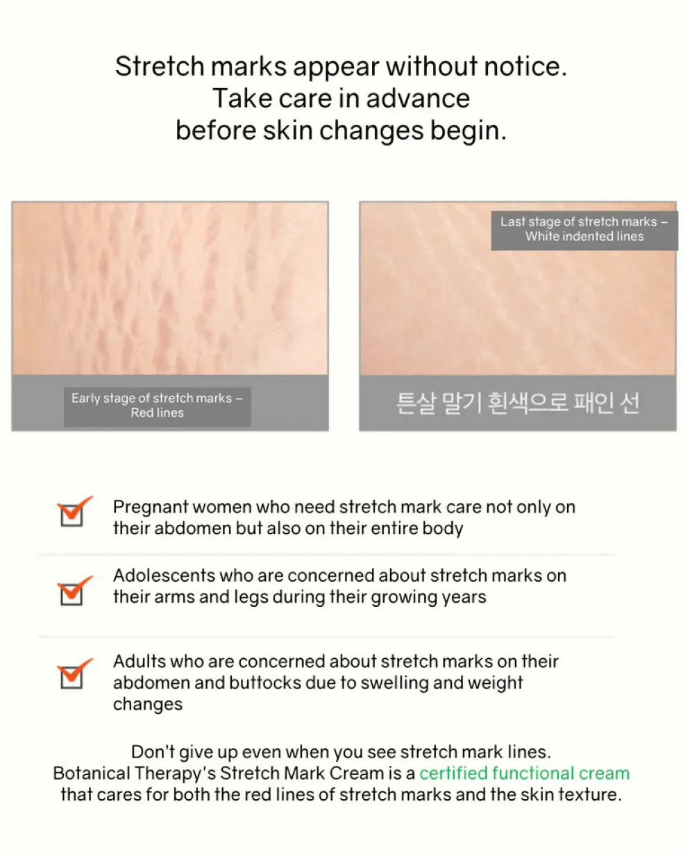 Botanical Therapy Stretch Cream