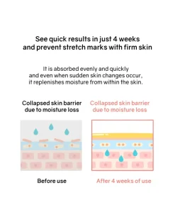 Botanical Therapy Stretch Cream