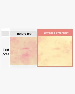 Botanical Therapy Stretch Cream