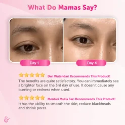 Mama's Choice Advanced Brightening Serum