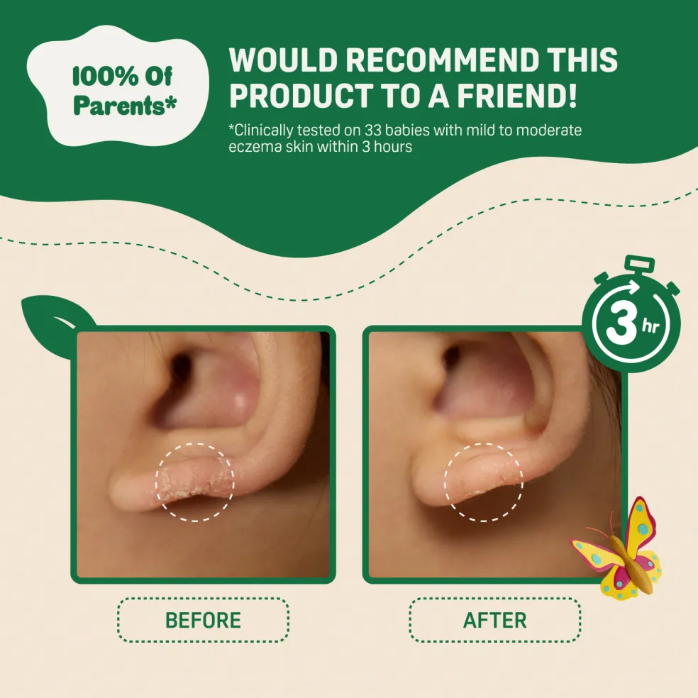 Pigeon Natural Botanical Baby Dermasoothe Cream 50ML